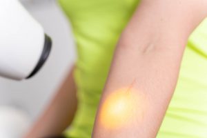 light therapy southampton